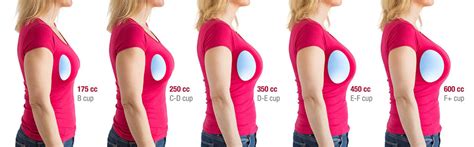 can your boob pop|[UPDATE]: Breast implants: can you *really* tell and does it.